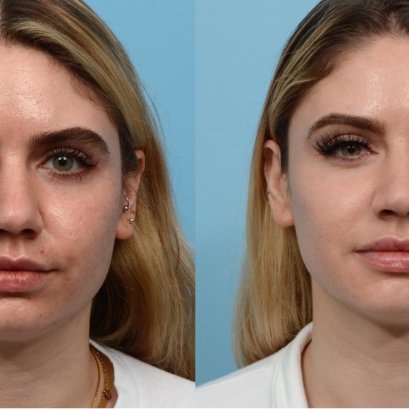 Shani Darden by Déesse PRO LED Light Mask FDA approved 
LED Light Therapy mask - Picture 12 of 12